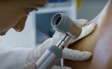AI to fight skin cancer 